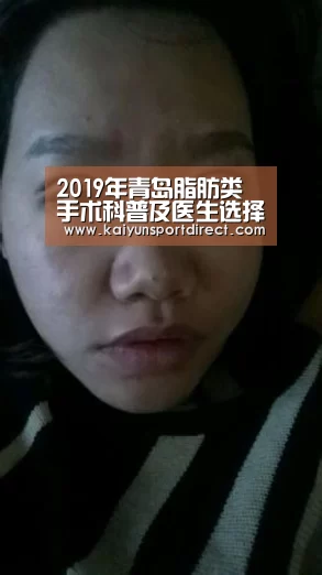 2019年青岛脂肪类手术科普及医生选择攻略|开云赛事(图2) 开云入口