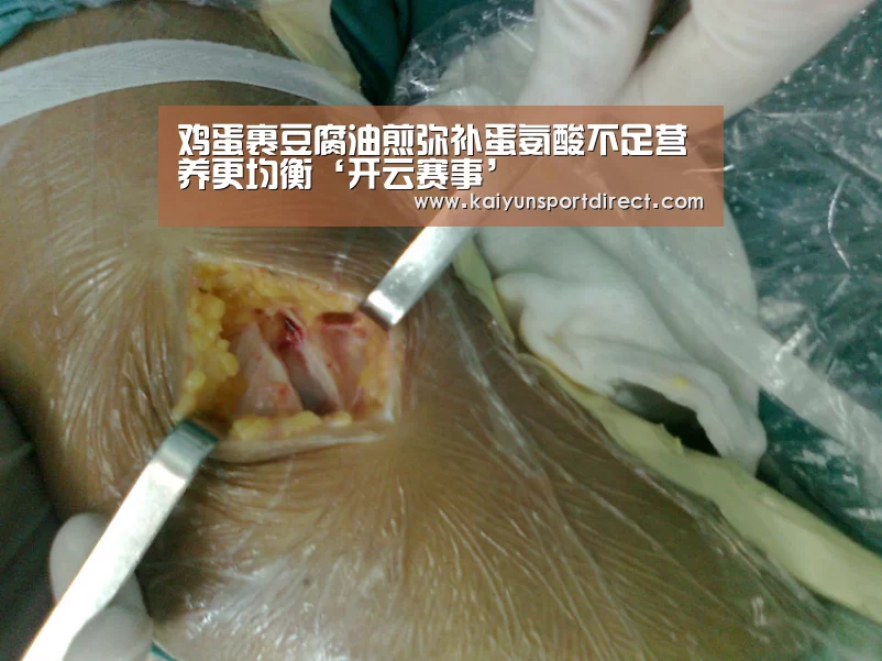 鸡蛋裹豆腐油煎弥补蛋氨酸不足营养更均衡‘开云赛事’(图3) 开云赛程